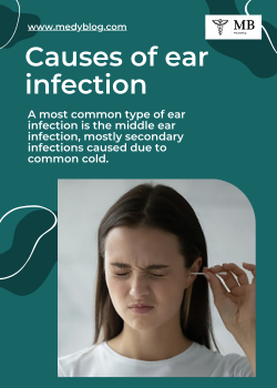 causes o fan ear infection.