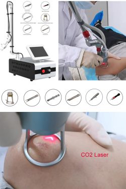 CO2 fractional laser facial treatment