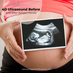 4D Ultrasound Before and After Tampa, Florida