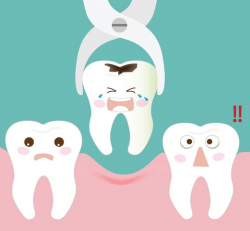 Dental Extractions Services Downey | Monica Puentes DDS