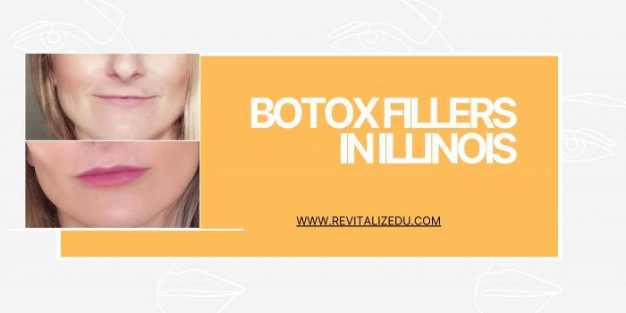 Get Youthful-Looking Skin By Botox Fillers in Illinois