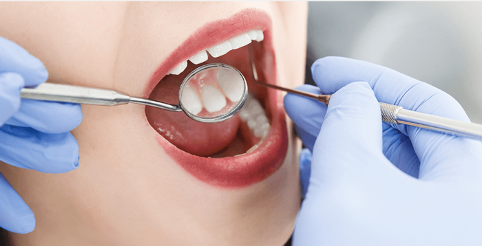 Walk-In Emergency Dentist Downey | Monica Puentes DDS