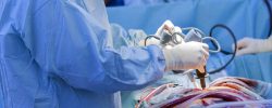 Things To Know Before Undergoing A Heart Surgery