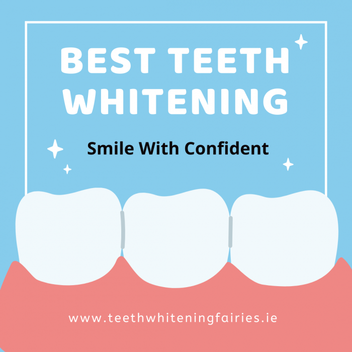 professional and experienced dental whitening in Dublin