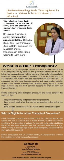 Understanding Hair Transplant Surgeon in Delhi – What it is and How it Works?