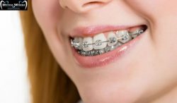 Find the best orthodontist in Delhi