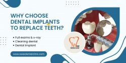 Dental Implant Clinic in Jaipur