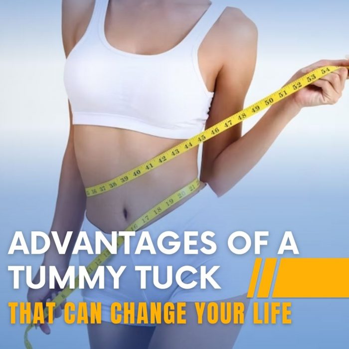 Advantages of a Tummy Tuck That Can Change Your Life