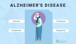 What is Alzheimer’s: Causes, Symptoms, Diagnosis, Treatment