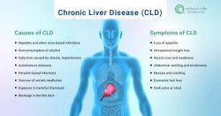 Chronic Liver Disease (CLD) – Causes, Symptoms, Available Treatments