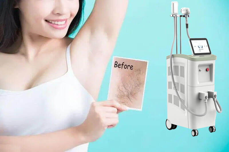Do you know more about laser hair removal