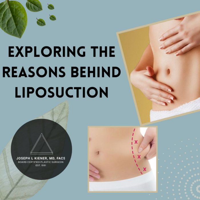 Exploring The Reasons Behind Liposuction