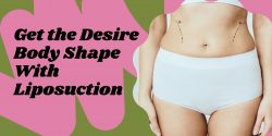 Get the Desire Body Shape With Liposuction