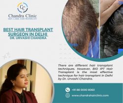 Hair Transplant in Delhi – Hair Transplant Technology in Delhi at Chandra Clinic will Amaz ...