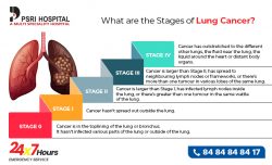 What are the Stages of Lung Cancer?