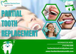 Types of Partial Dentures Tooth Replacement | Harbor Dental Care