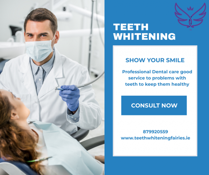 Teeth Whitening Fairies