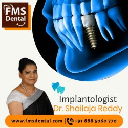 Best Dental Implantologists In Hyderabad India