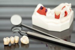 Teeth Bleaching Near Me | Teeth Bleaching Dentist in Houston TX