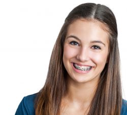 What are the different types of braces for teeth