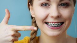 Straightening Teeth with Invisalign· Ivanov Orthodontic Experts