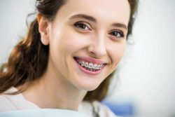 How You Can Find the Best Rated Orthodontist Near Me | IVANOV Ortho