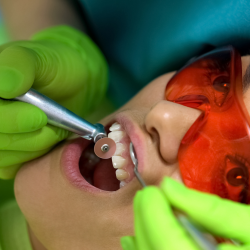 What is Advanced cosmetic dentistry where to get the best Advanced cosmetic dentistry done?