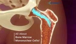 All About Bone Marrow Mononuclear Cells!
