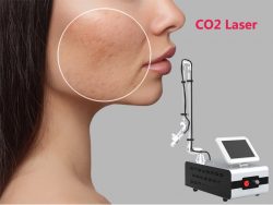 What is CO2 laser resurfacing