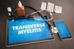 Transverse Myelitis Tetanus (TM) Vaccine | Vaccine Law