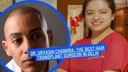 Dr. Urvashi Chandra: The Best Hair Transplant Surgeon in Delhi
