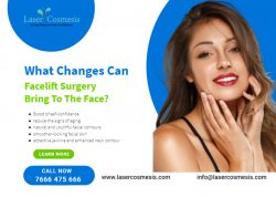 facelift surgery change your appearance