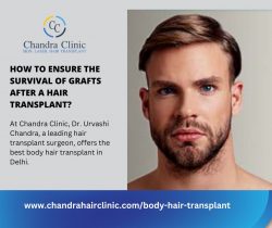 Get the Best Body Hair Transplant in Delhi at Chandra Clinic