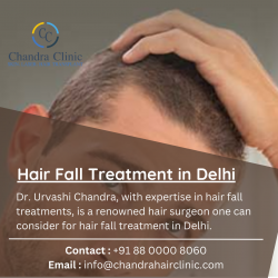 Hair Fall Treatment in Delhi – Chandra Clinic
