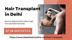Hair Transplant in Delhi | SB Aesthetics
