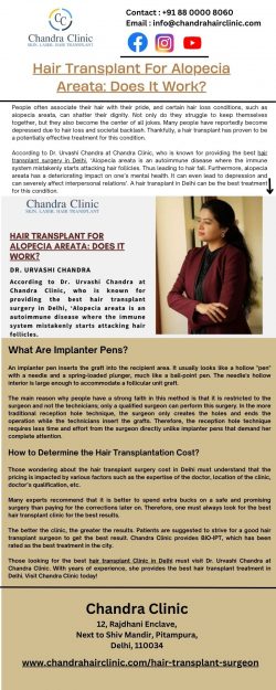 Hair Transplant Surgery in Delhi – Hair Transplant For Alopecia Areata – Does It Work?