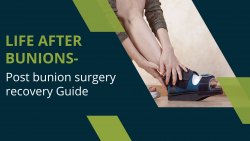 “Life after Bunions-Post bunion surgery recovery Guide “