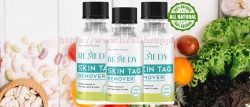 Remedy Skin Tag Remover Unwanted Moles And Pesky Skin Tags Easily To Apply With This Serum Painl ...