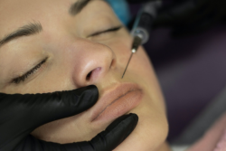 Lip Filler Trends: What Works and What Doesn’t Work-Vivid Skin & Laser Center