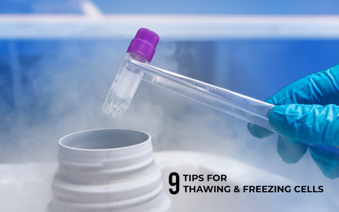 9 Tips for Thawing and Freezing Cells