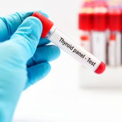 Book Thyroid Test in Noida at Affordable Rates!!