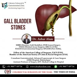 Advanced Laparoscopic Surgery for Gall bladder Stone