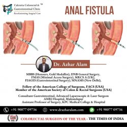 Best Fistula Surgeon in Kolkata