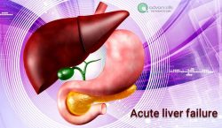 What Causes Liver Failure?