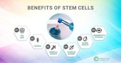 Benefits of Stem Cell Treatment