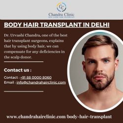 Affordable Body Hair Transplant Cost in Delhi at Chandra Clinic