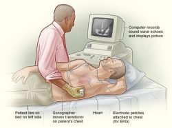 Echocardiogram Test Vaishali Nagar