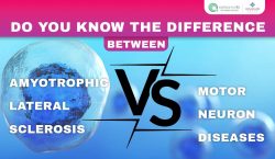 Do You Know The Difference Between ALS and Other Motor Neuron Diseases?