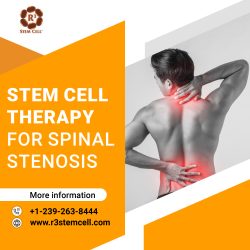 Spinal Stenosis Relief Through Stem Cell Therapy – Dr. David Greene Arizona
