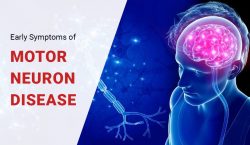 Early Symptoms of Motor Neuron Disease
